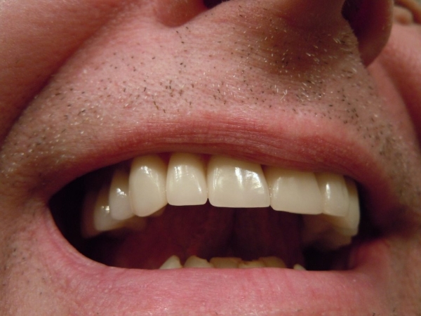Стоматологи напряглись. В Японии создали препарат для роста зубов